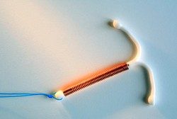 Copper T Iud Review 